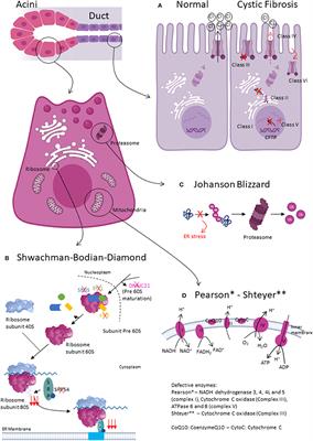 Congenital etiologies of exocrine pancreatic insufficiency